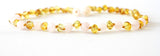 Amber games stone